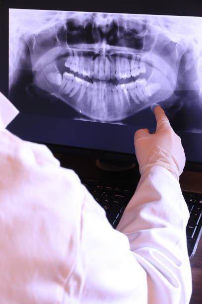 Best Emergency Dental Care for Broken or Chipped Teeth in Milton Freewater, OR