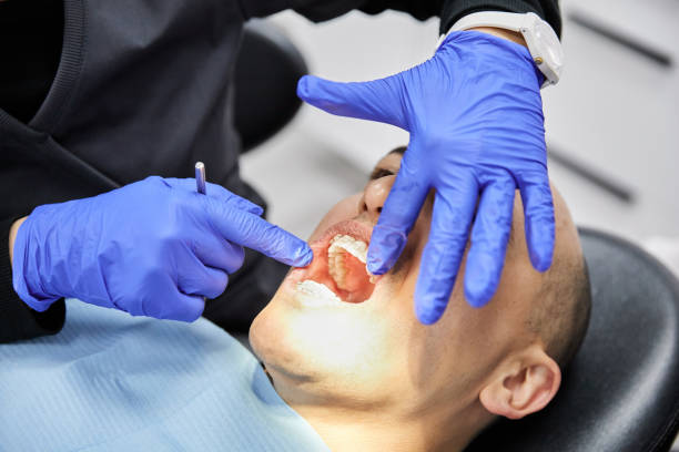 Best Emergency Treatment for Dental Infections or Abscesses in Milton Freewater, OR